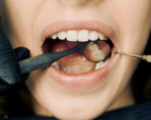 Foods for Oral Health